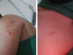 Satu Korban Mengalami Luka Tembak Diberondong Laras Panjang oleh OTK , Dikantor Kuari PT Dadi Maju di Desa Sungai Pinang